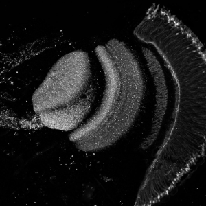 obraz z mikroskopu elektronowego przedstawiający nerw wzrokowy drosophila