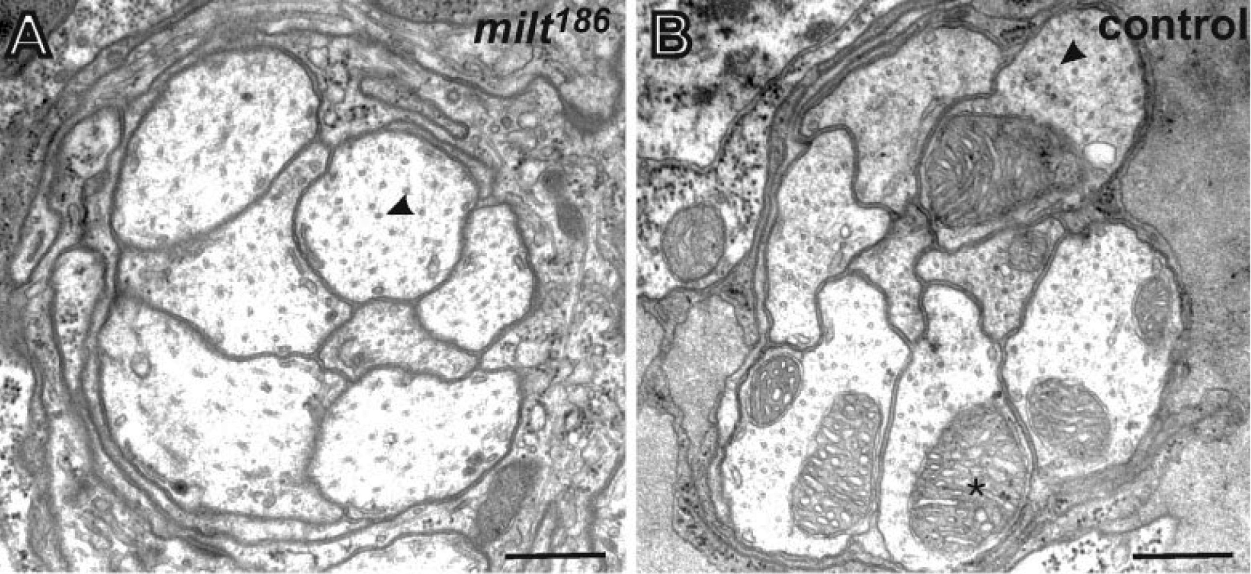Obraz z mikroskopu elektronowego przedstawiający mitochondria