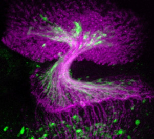 Komórki glejowe w mikroskopie fluorescencyjnym.