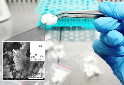 Bioaktywne szkło trzymane w pęsecie. Poniżej zdjęcie z mikroskopu elektronowego szkła bioaktywnego.